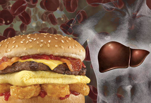 Cholesterol và những điều cần lưu ý